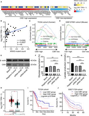 Identification of calcium and integrin-binding protein 1 as a reprogrammed glucose metabolism mediator to restrict immune cell infiltration in the stromal compartment of pancreatic ductal adenocarcinoma